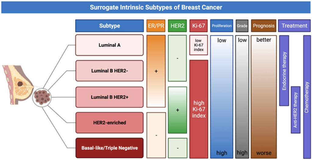 The figure provides a schematic representation of surrogate intrinsic BC subtypes, based on histologic and molecular features, which have significant implication for prognosis and treatment choice.